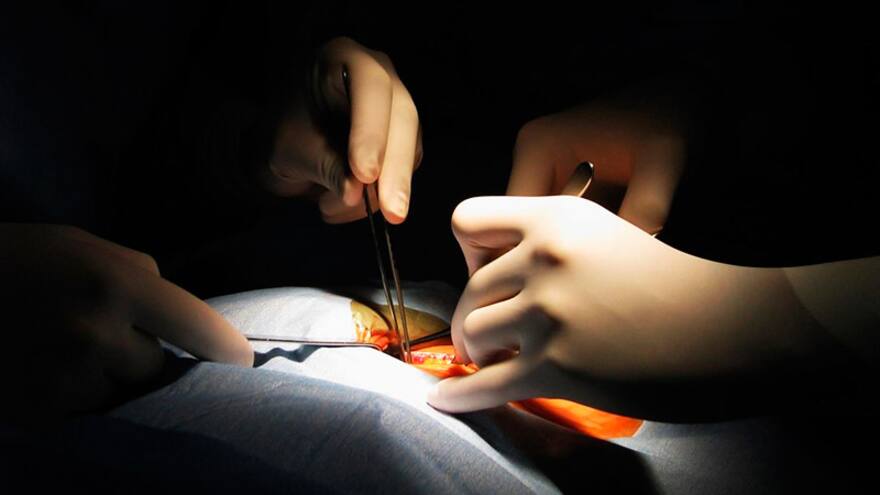 Se agrava crisis por tráfico ilegal de trasplantes, advierte ONT