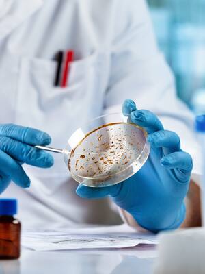 Bacterias amenazan los olímpicos | Columna de Álvaro Villanueva