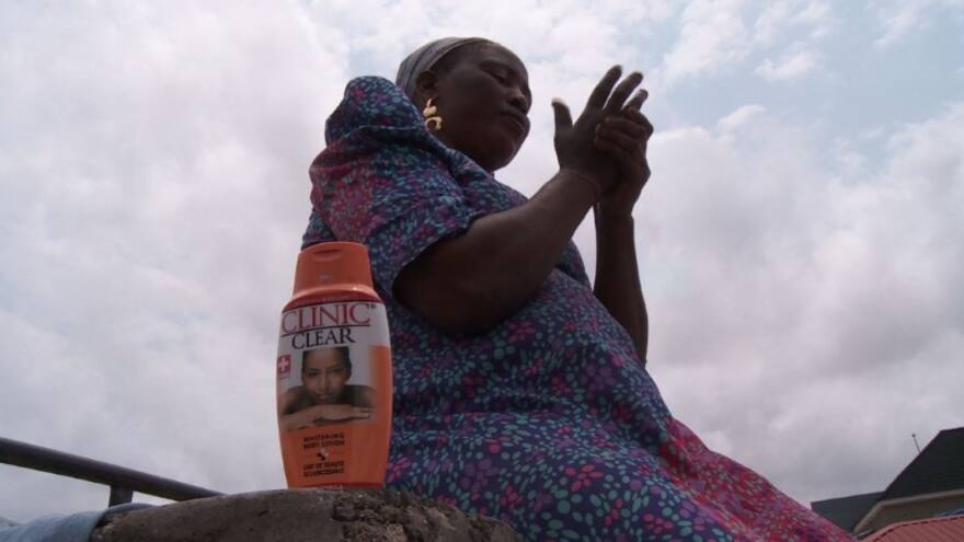 Productos para blanquear la piel hacen furor en África