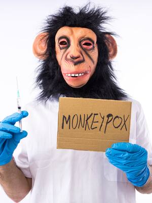 ¿La viruela del mono, amenaza mundial? | Columna de José Consuegra