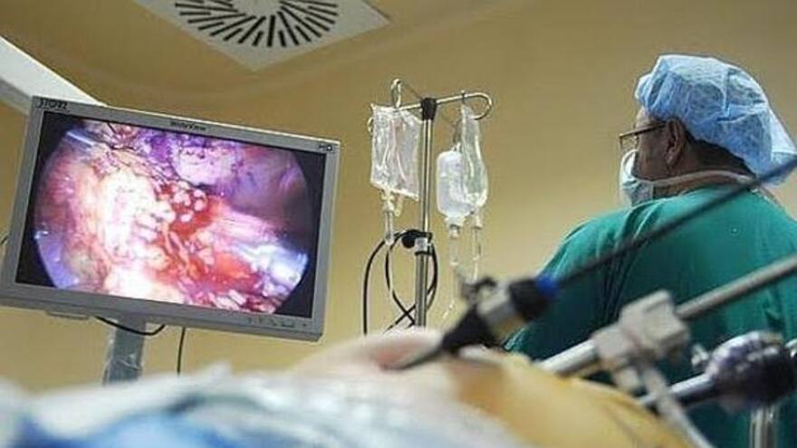 Colonoscopia oportuna reduce en 67% riesgo de morir por cáncer colorrectal