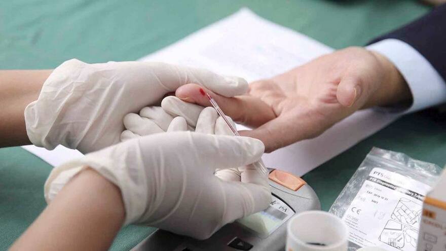 Biomarcador de diabetes identifica aterosclerósis