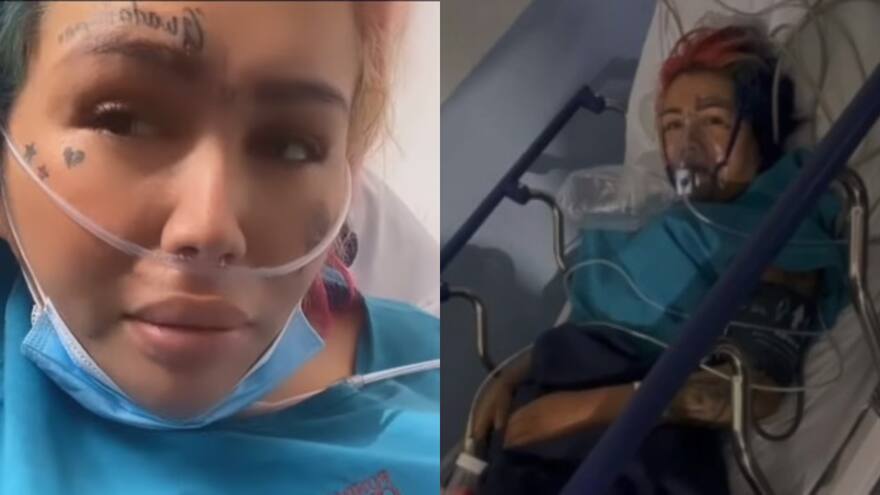 Yina Calderón, en urgencias tras quitarse las costillas