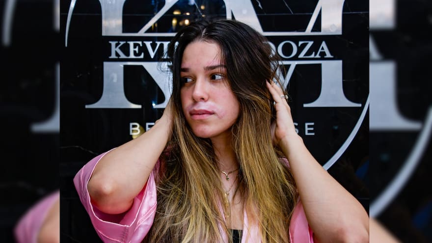 Cuidados para después de Carnaval