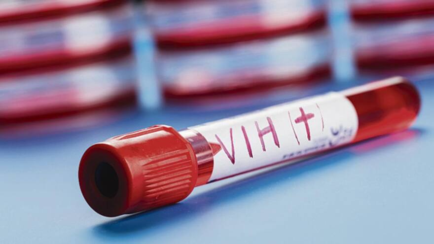 Casos de sida aumentan en Latinoamérica y un 25 % no accede a tratamientos