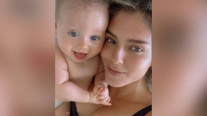 Laura Tobón pidió ayuda tras malformación que le apareció a su bebé