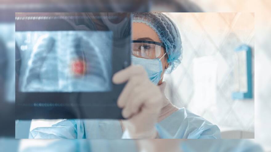 No fumar, un respiro necesario para combatir el cáncer de pulmón