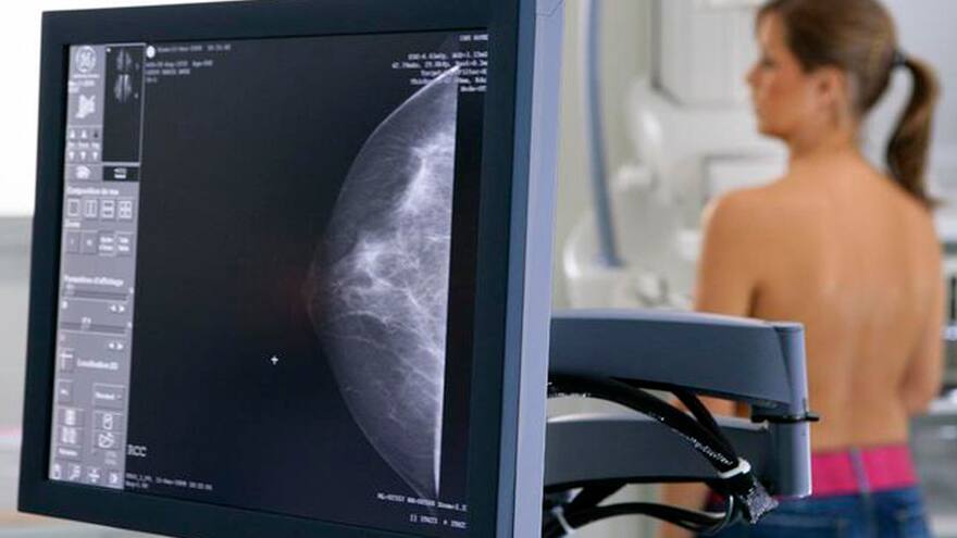 Cáncer de mama y ovario, de las patologías más mortales en mujeres