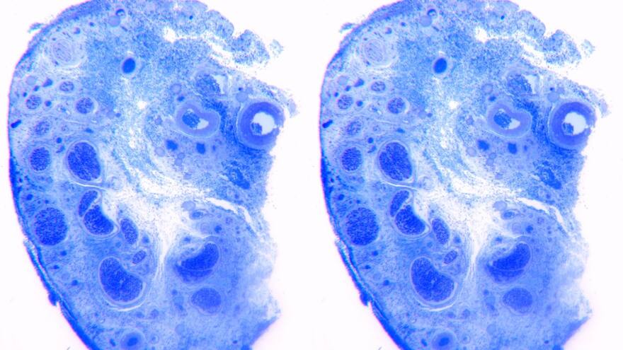 El clítoris humano contiene más de 10.000 fibras nerviosas, según estudio