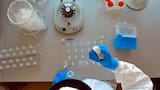 Hantavirus: datos clave y cuáles son las medidas preventivas para evitar un contagio