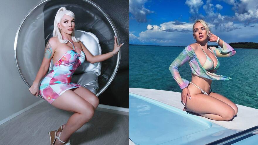 Amputan la pierna de una modelo tras infectarse con bacteria come carne