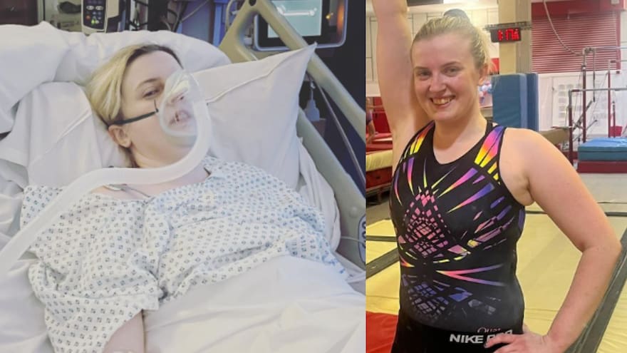 Caso de Natasha Coates, la mujer que no puede sentir emociones fuertes porque podría morir