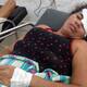 Una amiga le arrancó la ceja de un mordisco