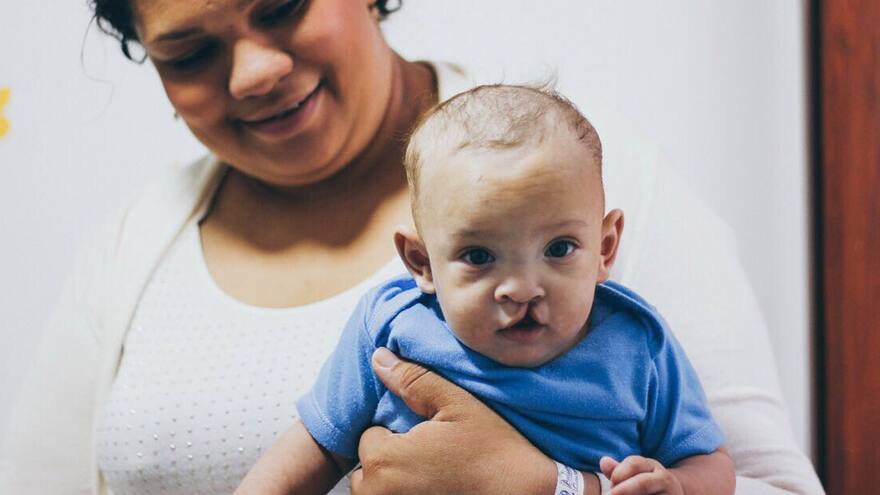 Operación Sonrisa realizará una nueva jornada en La Guajira
