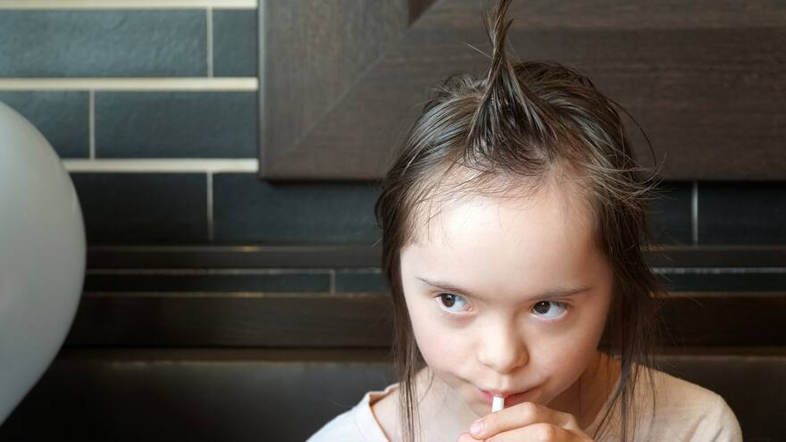 Suplementos de té verde pueden reducir rasgos de síndrome de Down